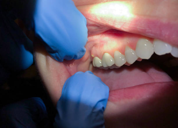 Best Weekend Emergency Dentist in Berwyn, IL